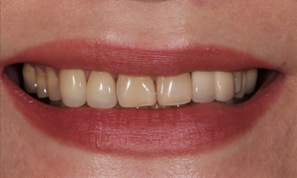 Esthetic dentistry before example 1