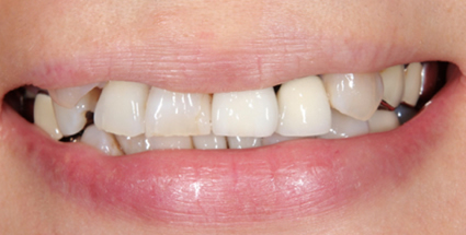 Esthetic dentistry before example 2