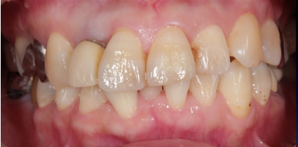 Esthetic dentistry before example 3