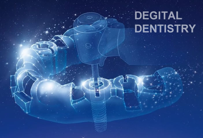 デジタル歯科治療