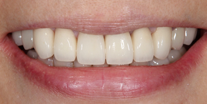 Esthetic dentistryafter example 1