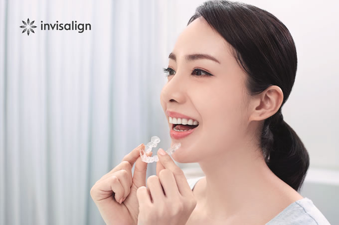 Woman with Invisalign treatment in Osaka