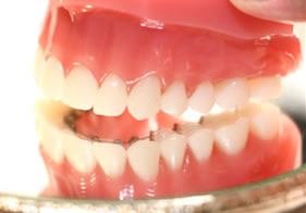 hidden braces with rear wire orthodontic treatment