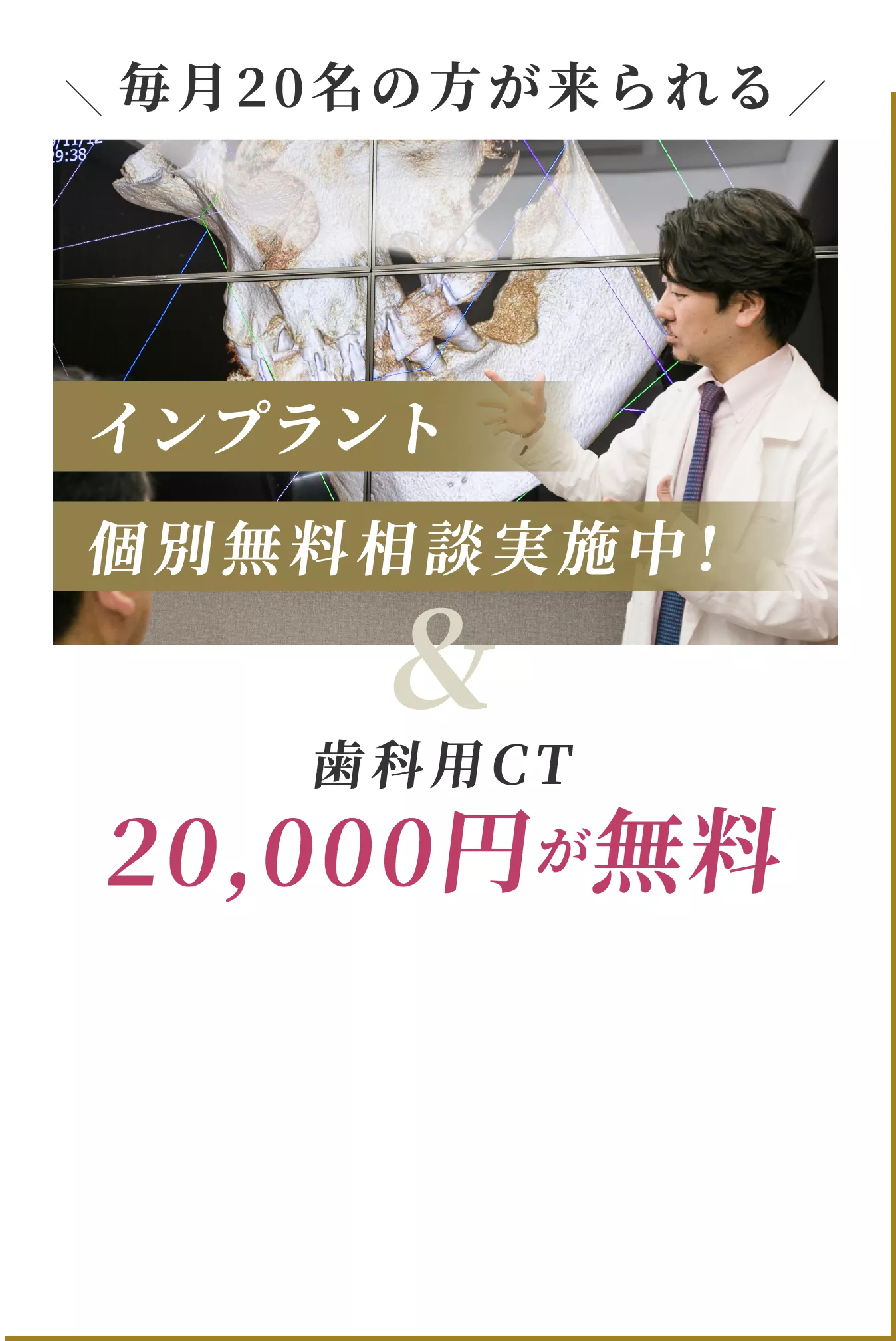 インプラント個別無料相談実施中!