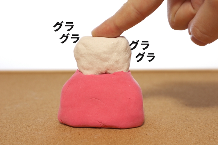 歯が抜ける原因と5つの悪い習慣｜予防法や抜けた場合の治療法について