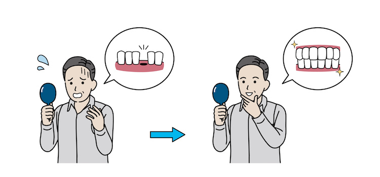 抜けやすい歯の特徴を解説｜4つのリスクに注目