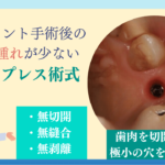 フラップレス術式｜歯肉を切開しない痛みと腫れの少ないインプラント