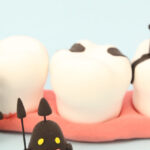 インプラントは歯周病になる？インプラント周囲炎や歯周病について徹底解説