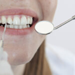 前歯はインプラントにするべき？前歯の治療の最適解を解説