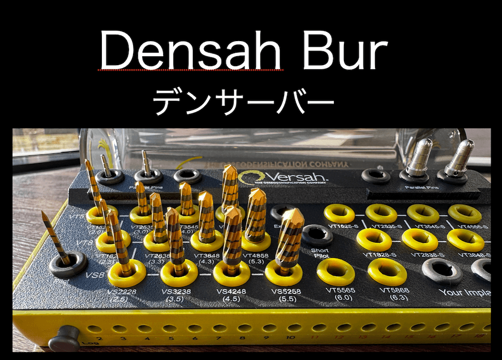 デンサーバー セット