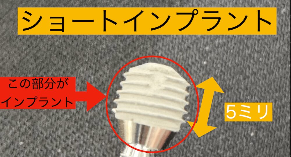 5mmのショートインプラント