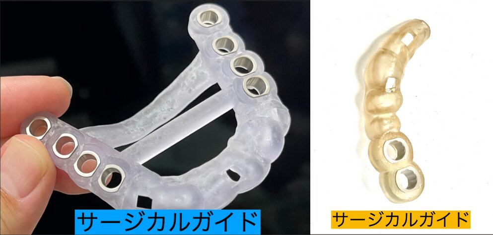 サージカルガイド