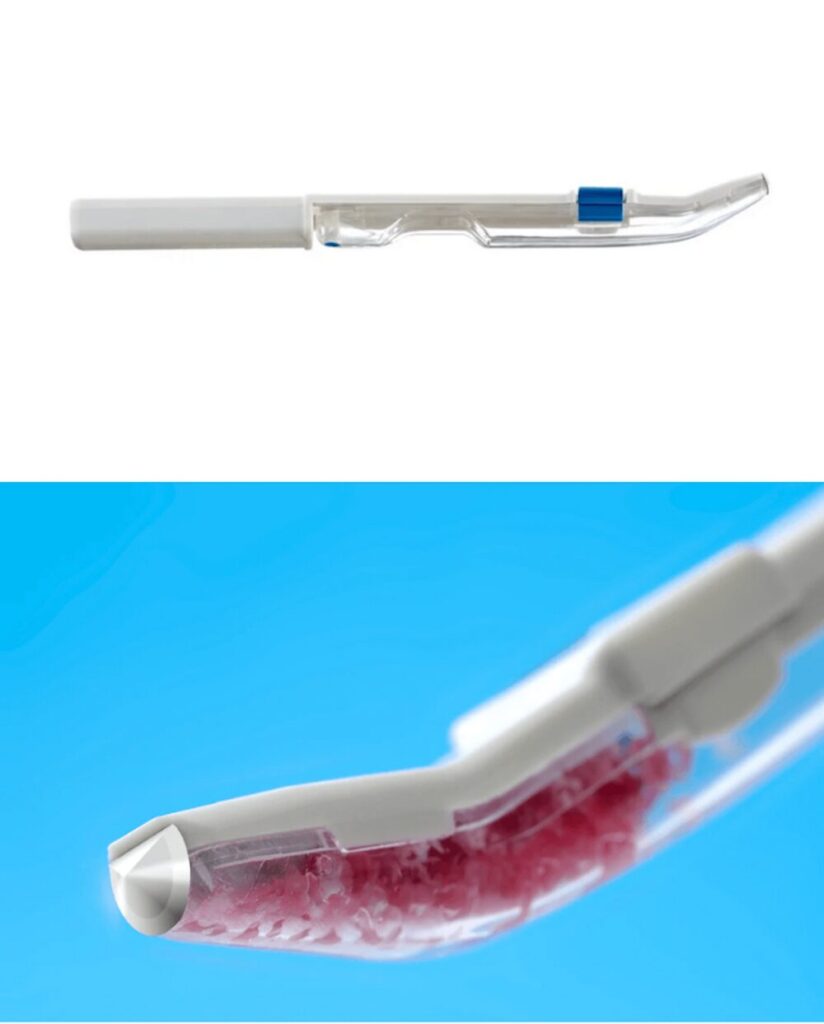 ボースクレイパー(自家骨を採取する器具)