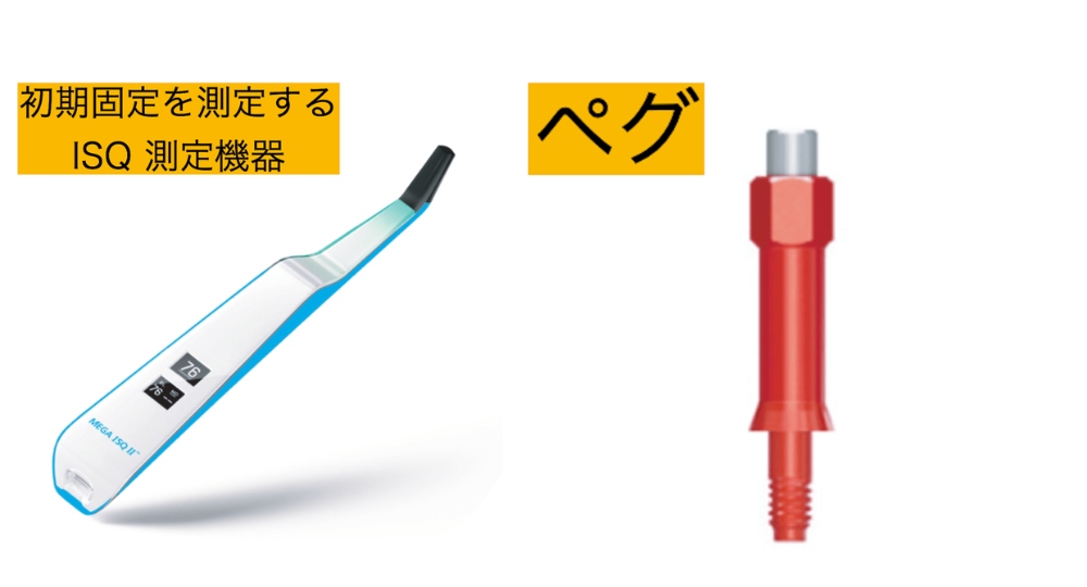 インプラントの初期固定を測定するISQ測定機器とペグ