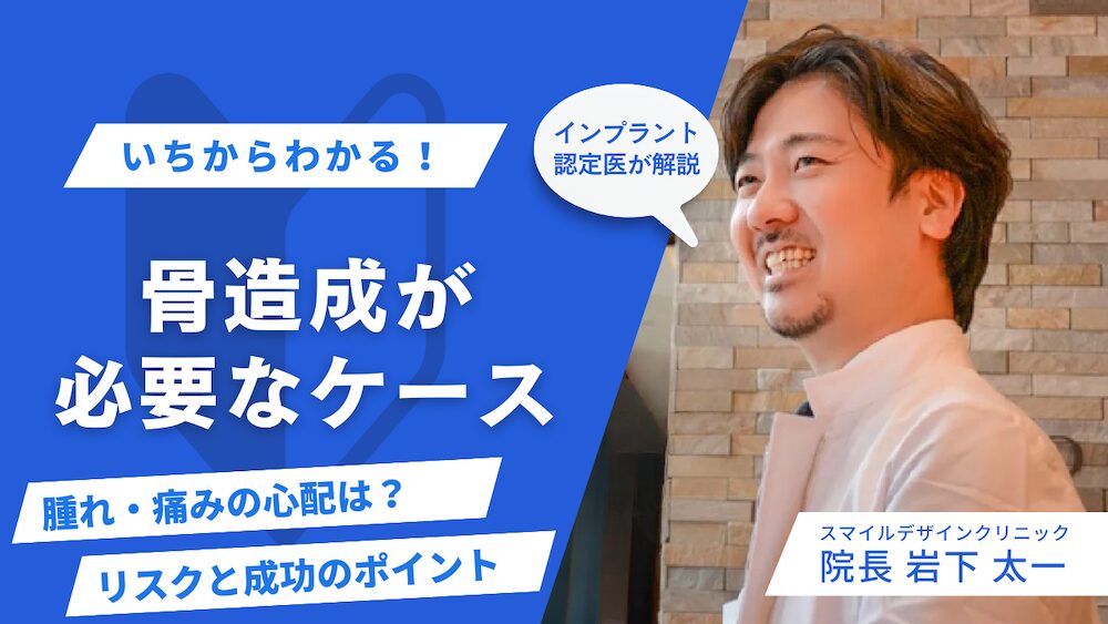 インプラントで骨造成が必要な場合とは｜腫れ・痛み・リスクと成功のポイント