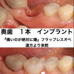 奥歯1本インプラント症例｜フラップレスオペで痛みを抑えた治療記録