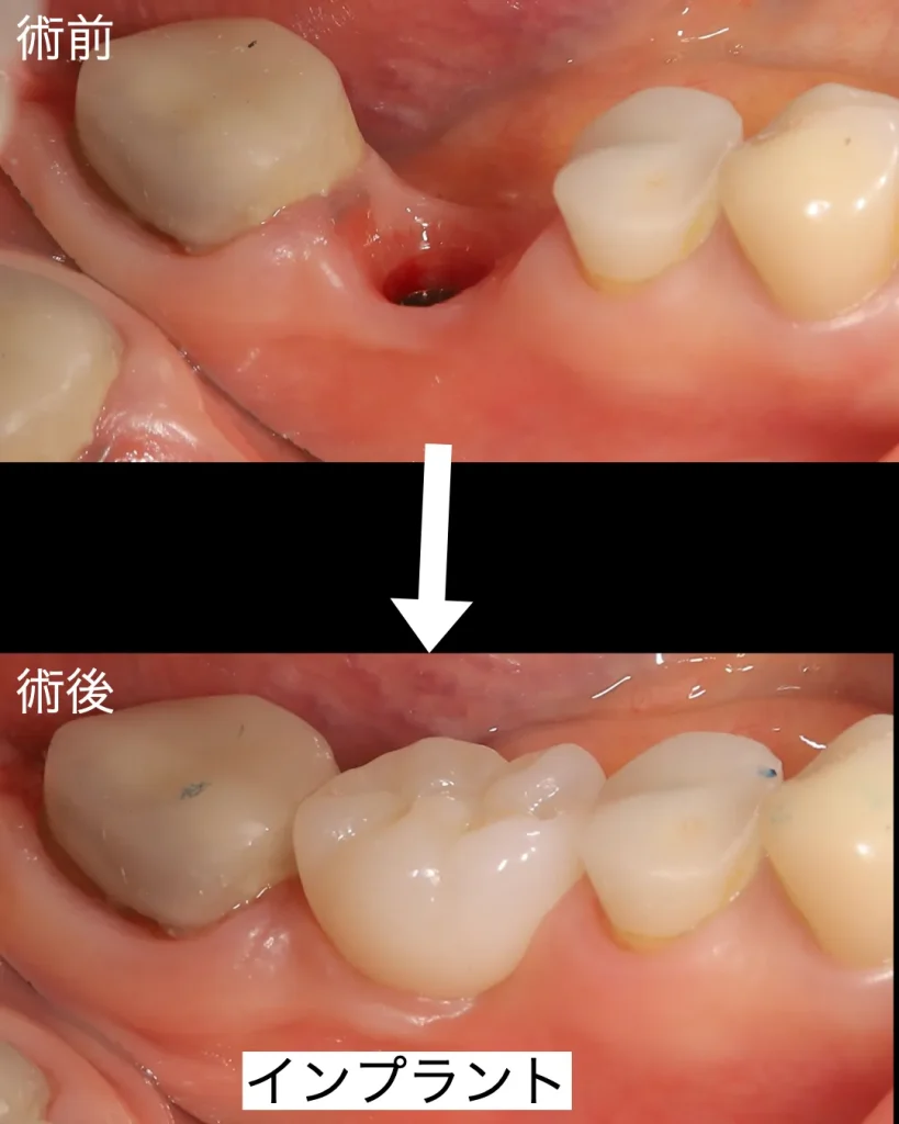 術前術後
