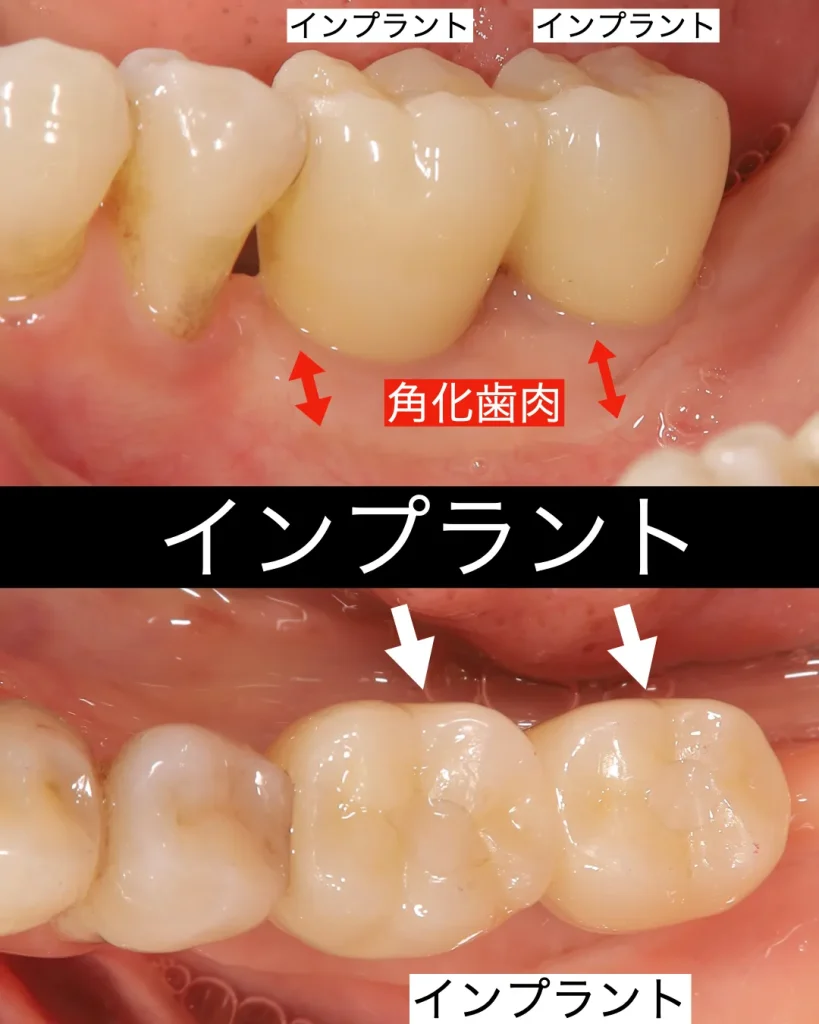 こうして無事に治療を終了することができ、患者様にも大変喜んでいただくことができました。