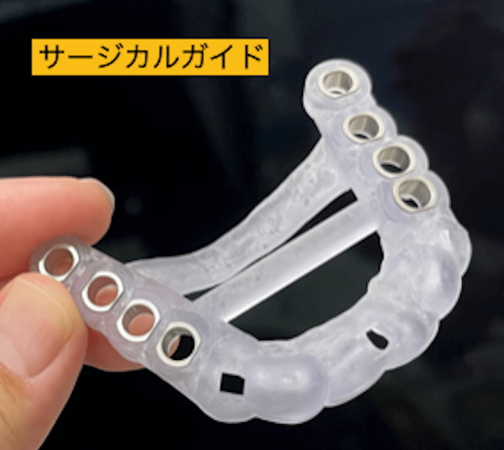 サージカルガイド
