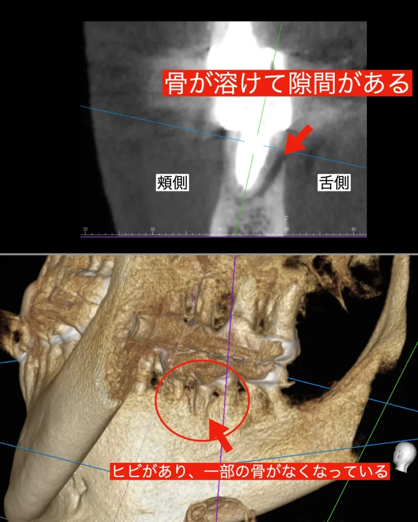 CT画像