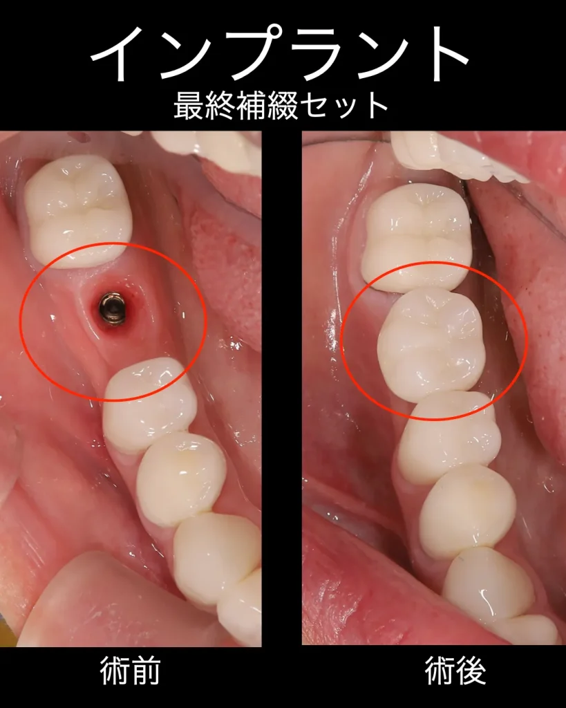 術前術後