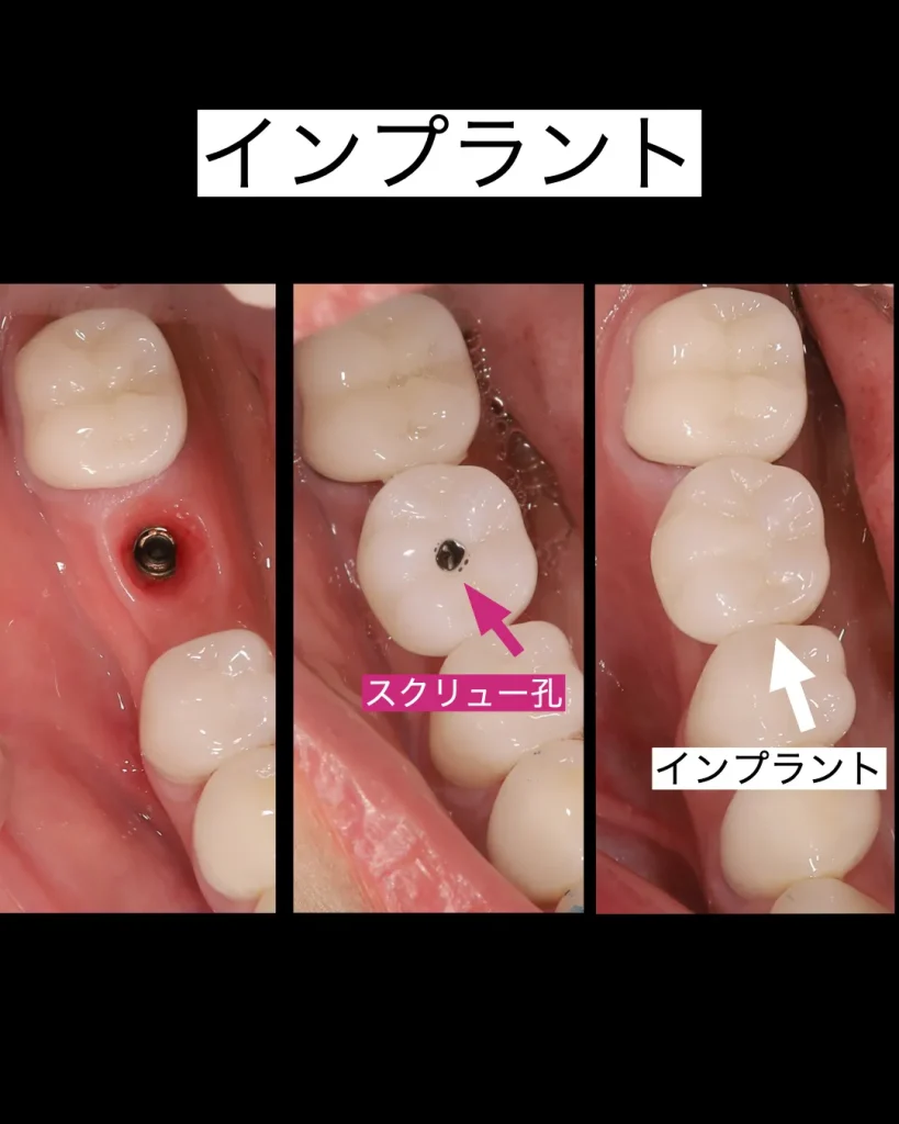 術前、術中、術後
