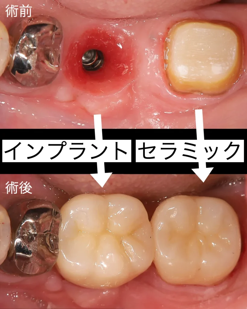 術前術後