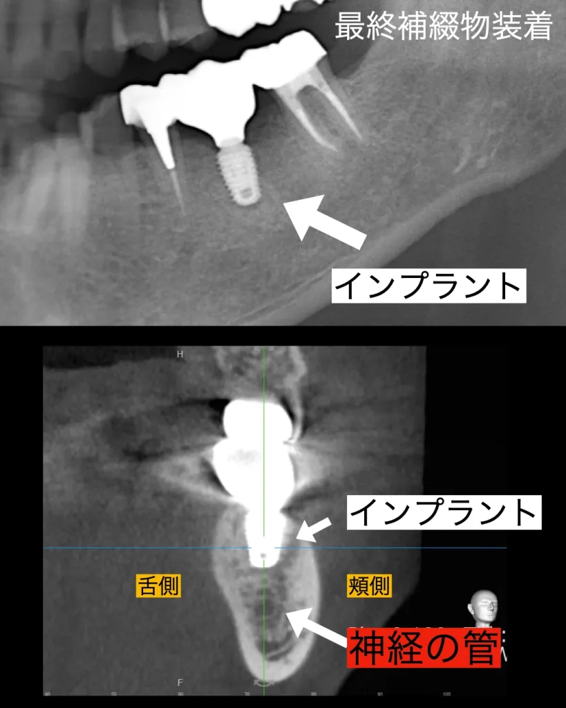 レントゲンCT画像
