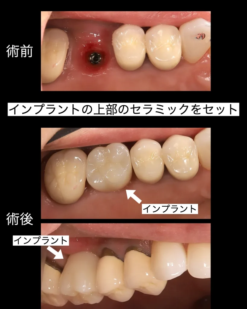 術前術後