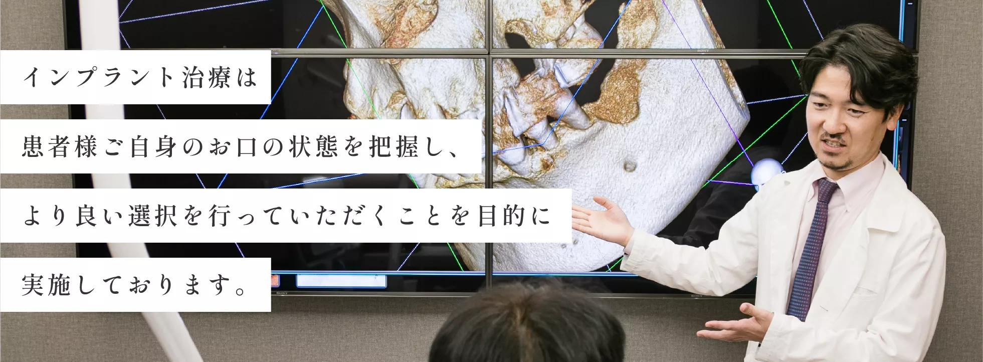 about