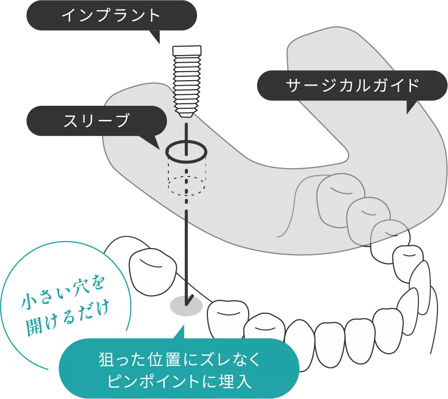 solution