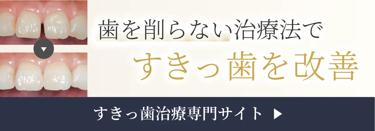 すきっ歯治療専門サイト