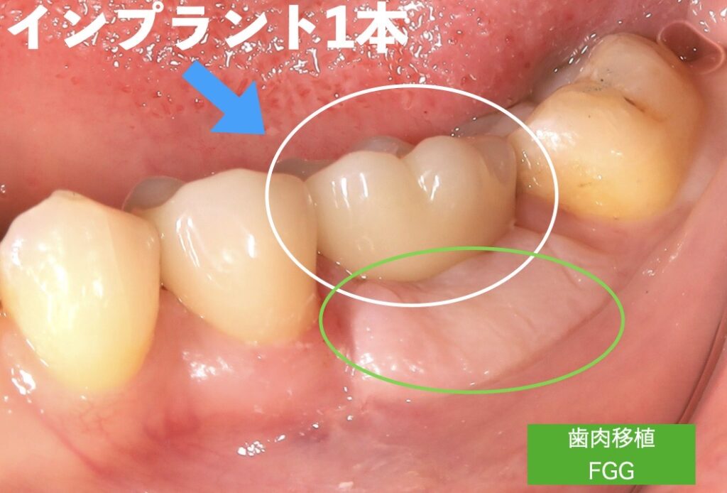 治療までの経緯