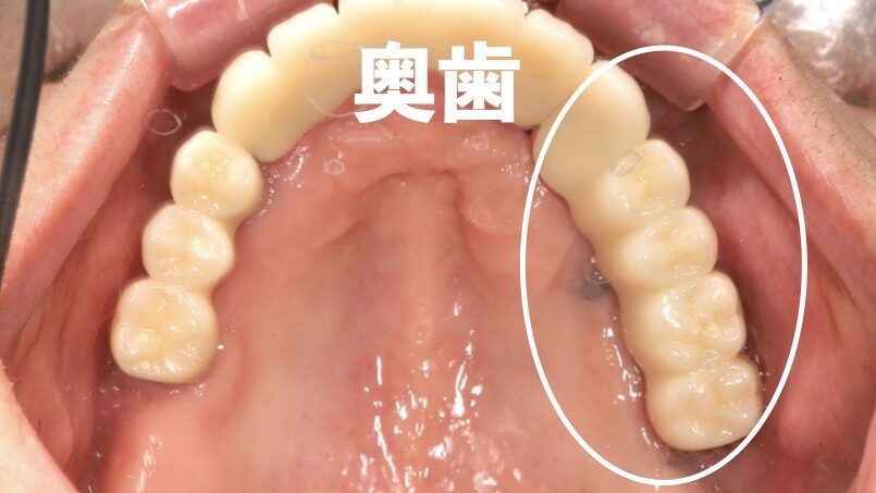 治療までの経緯