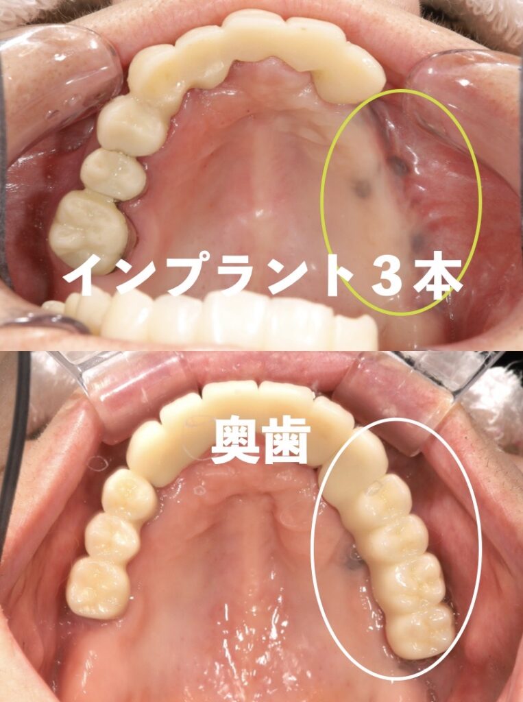 治療前後の写真