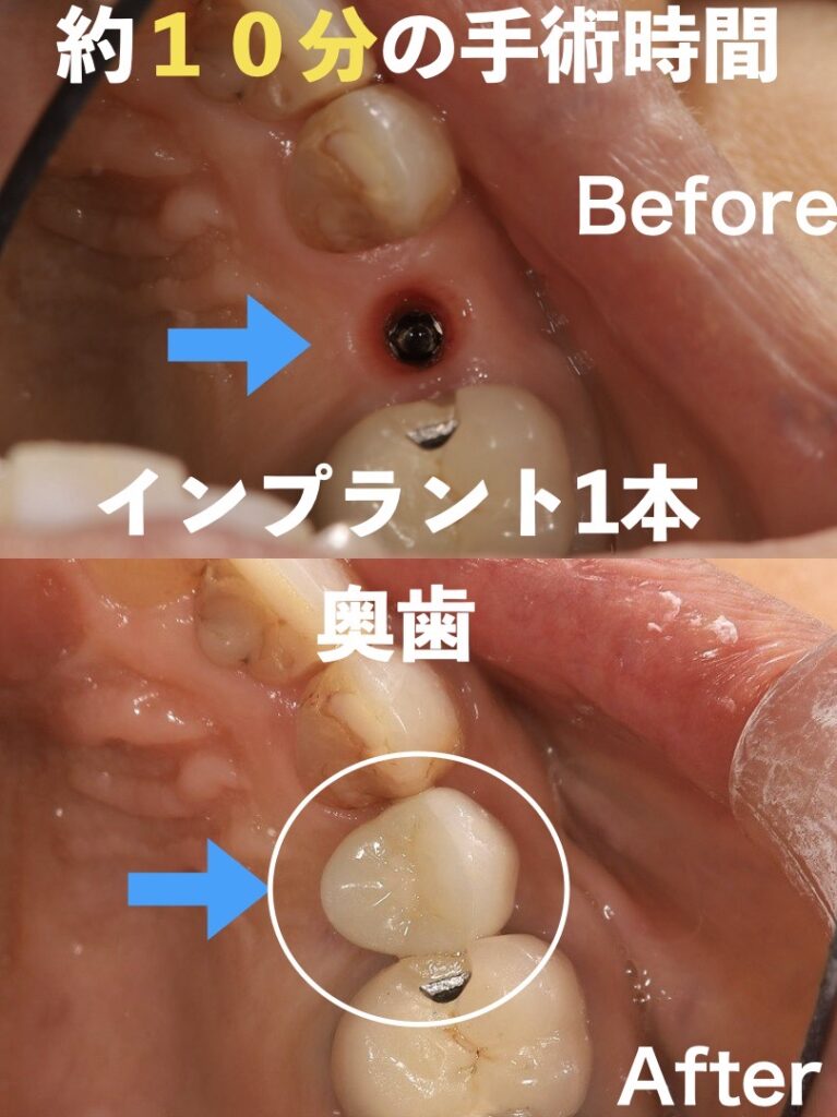 治療までの経緯